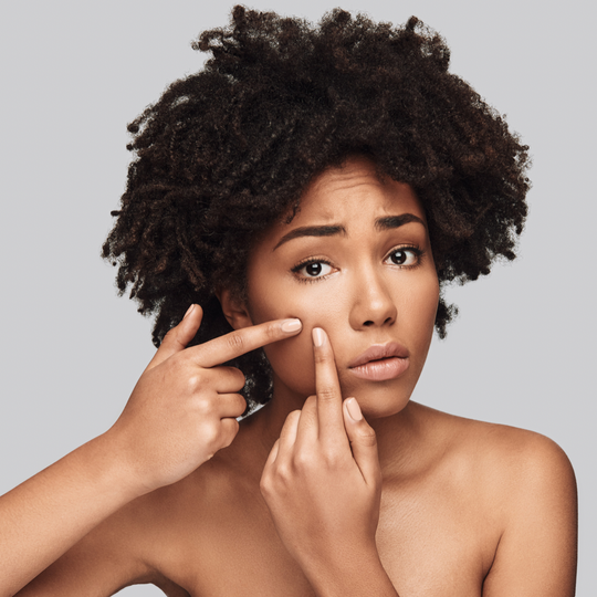Is Shea Butter Really Effective at Fighting Acne?