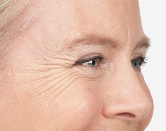 Say "Bye Bye" to Crows Feet - Easy Anti-Aging Eye Cream You Can Make At Home