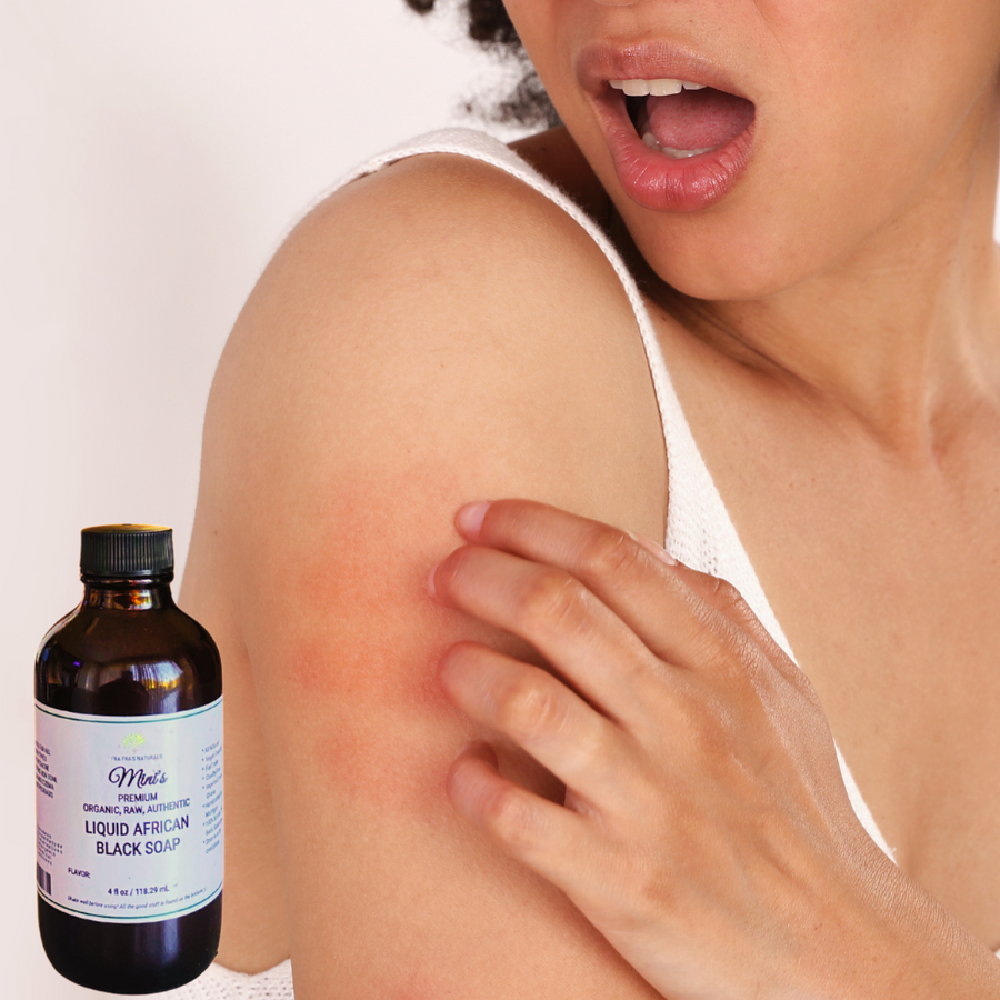 Fra Fra's mini's | Premium EXTREME Healing Eczema Blend Liquid African Black Soap