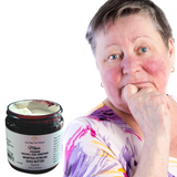 Fra Fra's Naturals | Premium Extreme Healing Rosacea Organic Raw Shea Butter