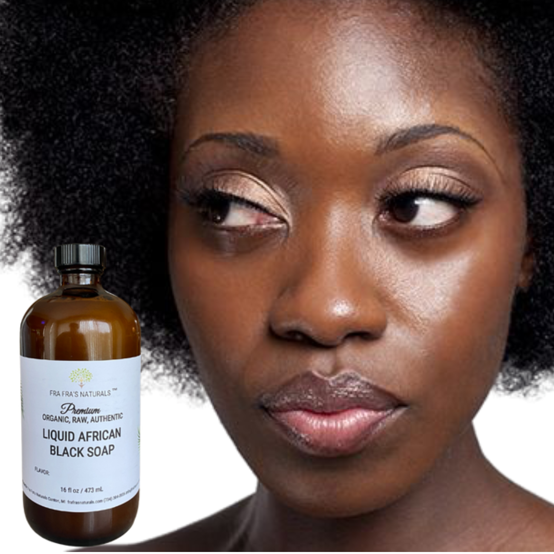 Fra Fra's Naturals I Premium EXTREME Healing Seborrheic Dermatitis Blend