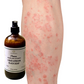 Fra Fra's Naturals | Premium Extreme Healing Psoriasis Liquid African Black Soap Blend - 16 oz