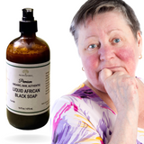 Fra Fra's Naturals | Premium Extreme Healing Rosacea Liquid African Black Soap