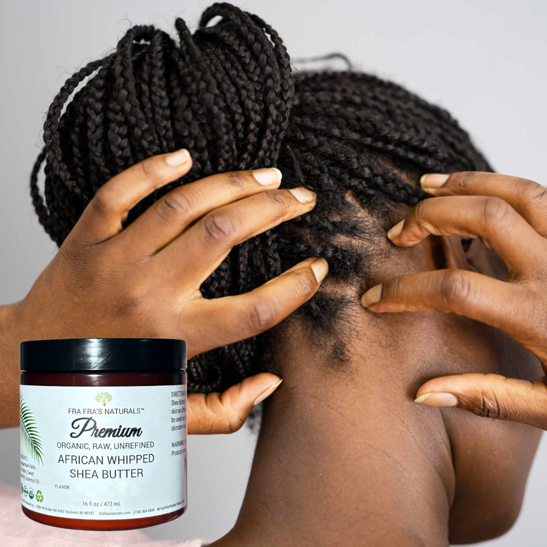 Fra Fra's Naturals I Premium EXTREME Healing Seborrheic Dermatitis Blend