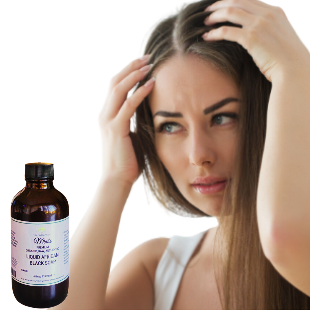 Fra Fra's Naturals I Premium EXTREME Healing Seborrheic Dermatitis Blend