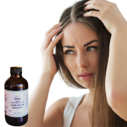 Fra Fra's Naturals I Premium EXTREME Healing Seborrheic Dermatitis Blend