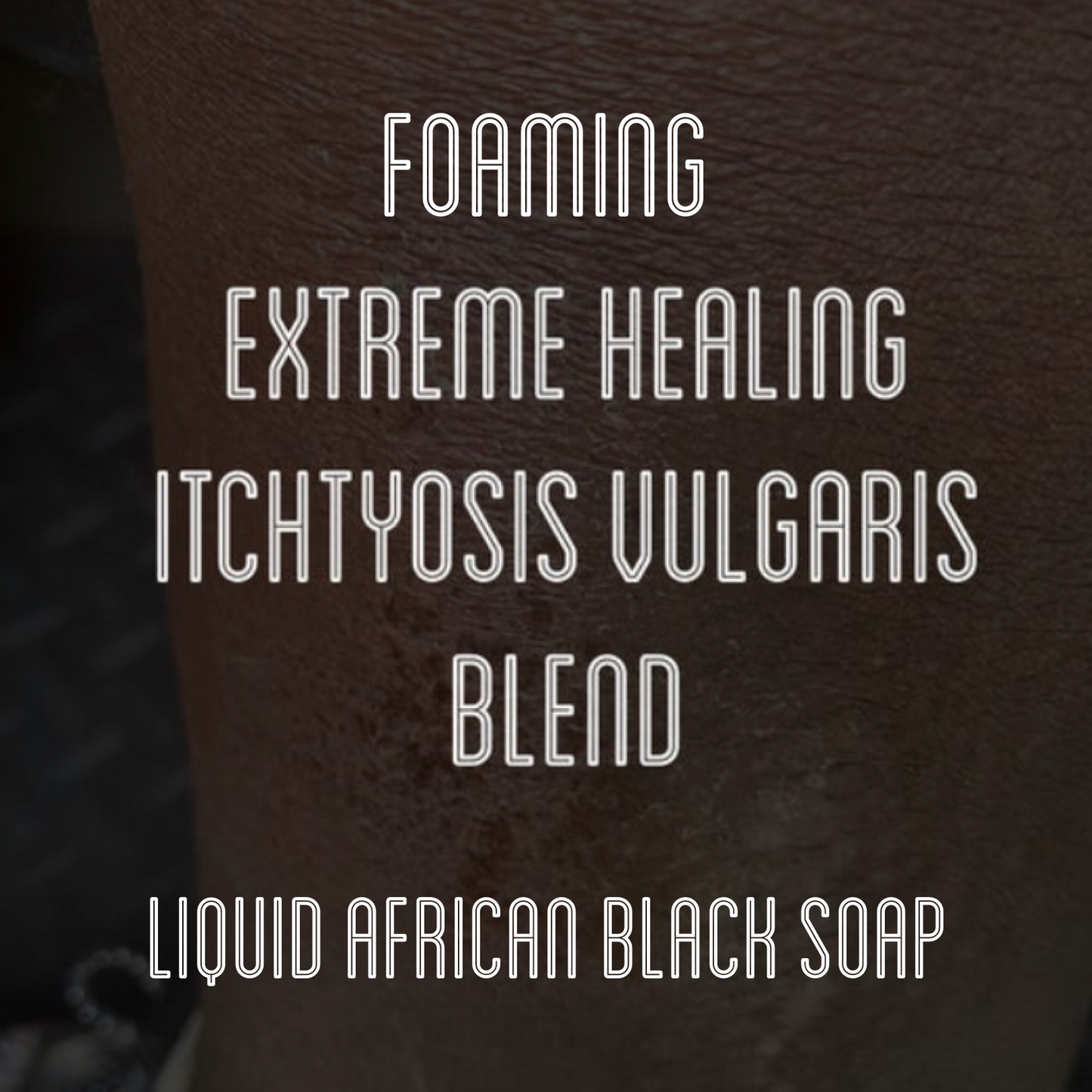 Fra Fra's Naturals | Premium Extreme Healing Itchtyosis Vulgaris Foaming African Black Soap Face and Body Wash