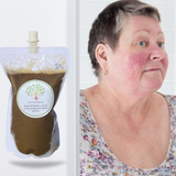 Fra Fra's Naturals | Premium Healing Liquid Black Soap Rosacea Blends