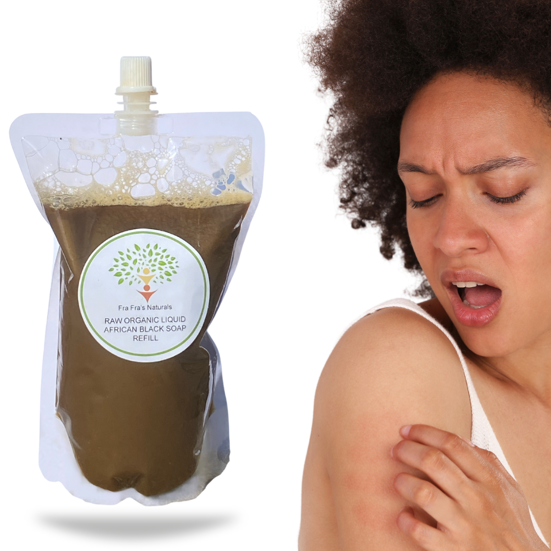 Fra Fra's Naturals | Premium Anti-Itch Liquid Black Soap Blend