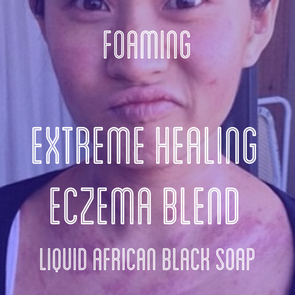 Fra Fra's Naturals | Premium EXTREME Healing Eczema Foaming African Black Soap Face and Body Wash