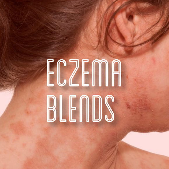 Fra Fra's Naturals | Premium Healing Eczema Blends