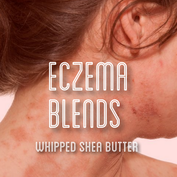 Fra Fra's Naturals | Premium Healing Eczema Blend Whipped Shea Butter