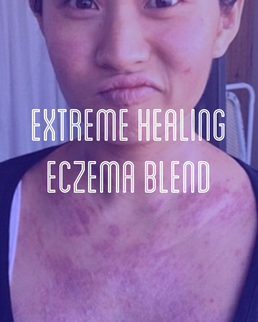 Fra Fra's Naturals | Premium EXTREME Healing Eczema Blends