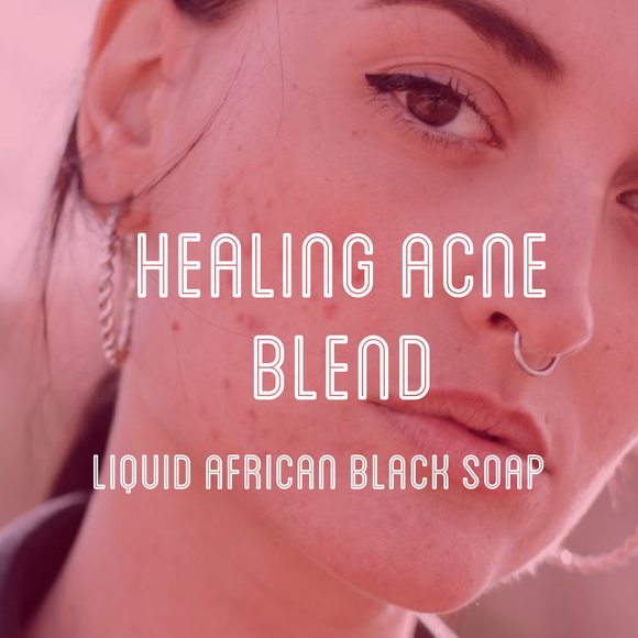 Fra Fra's Naturals | Premium Healing Acne Blend Liquid Black Soap