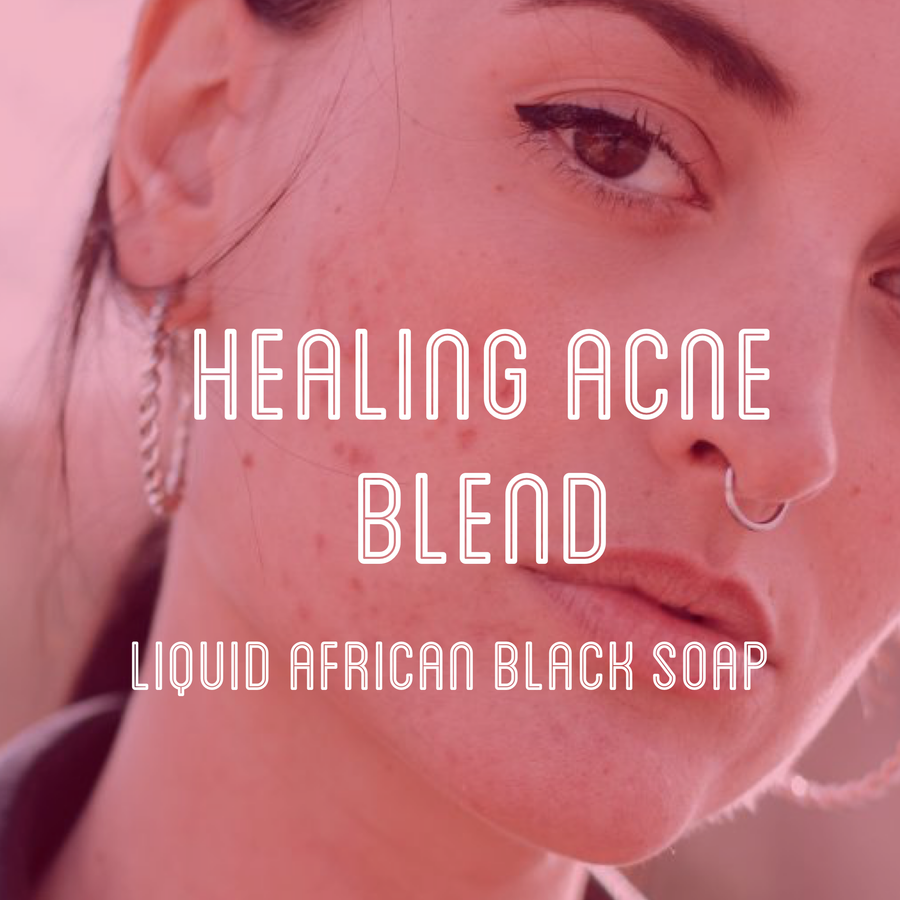 Fra Fra's Naturals | Premium Healing Acne Blend Liquid Black Soap