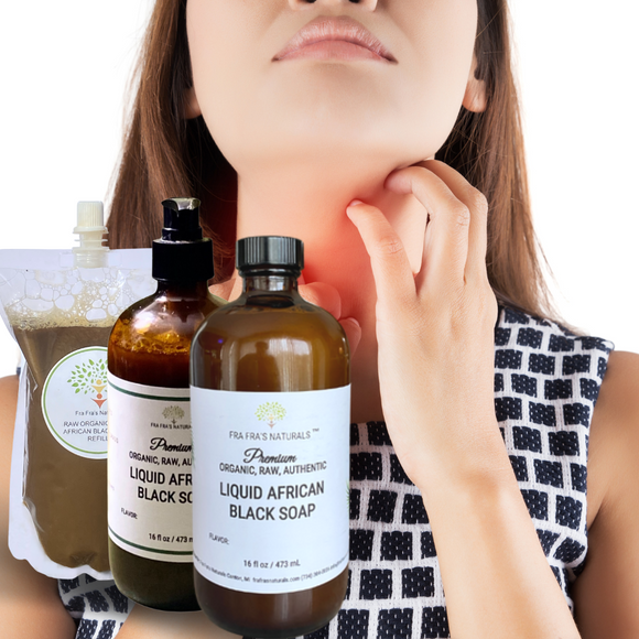 Fra Fra's Naturals | Premium Anti-Itch Liquid Black Soap Blend