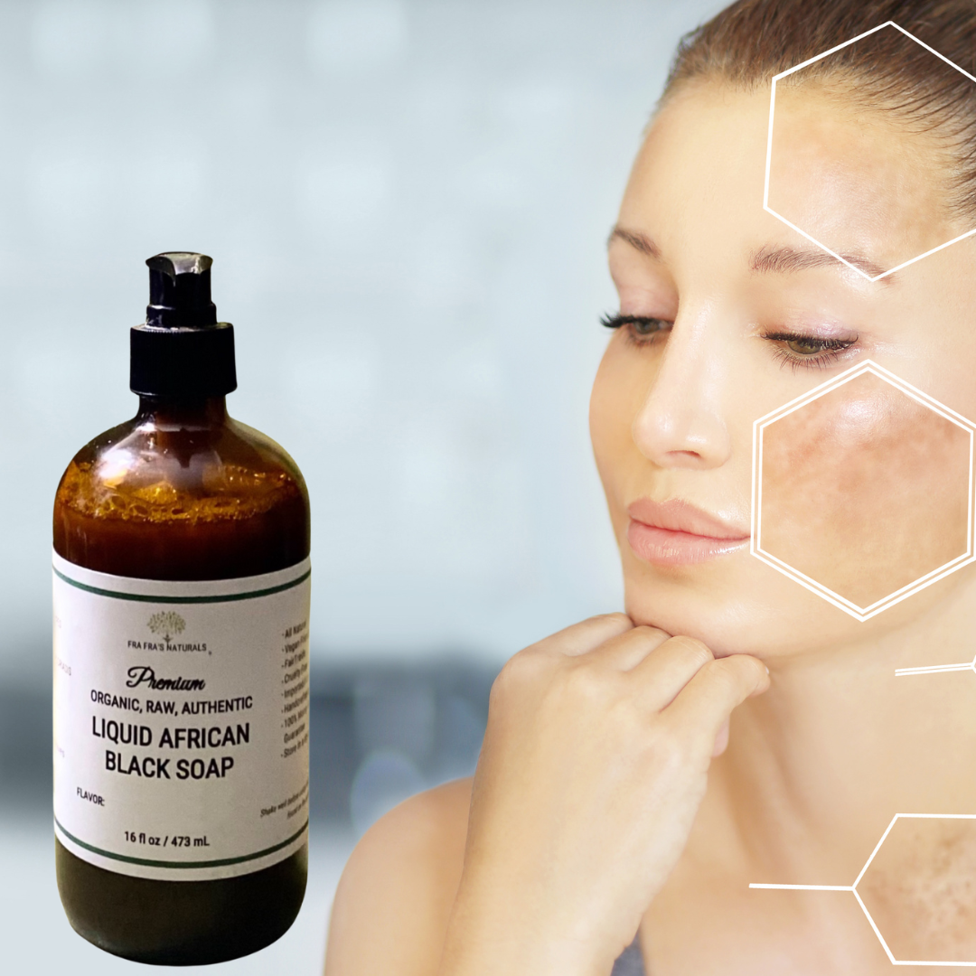 Fra Fra's Mini's | Premium Dark Spot Reducing Liquid Black Soap Blend - 4 oz